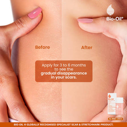 روغن  ترمیم کننده و تقویت‌کننده بایو اویل BIO-OIL 200ML